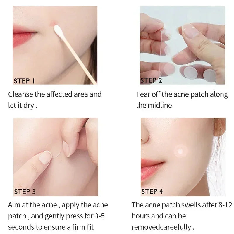 Invisible Acne Pimple Patches for Clearer Skin