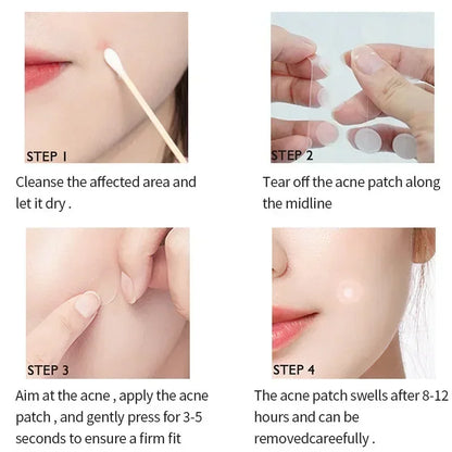 Invisible Acne Pimple Patches for Clearer Skin