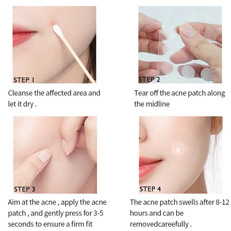 Invisible Acne Pimple Patches for Clearer Skin