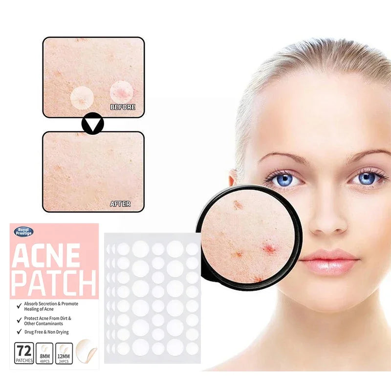 Invisible Acne Pimple Patches for Clearer Skin
