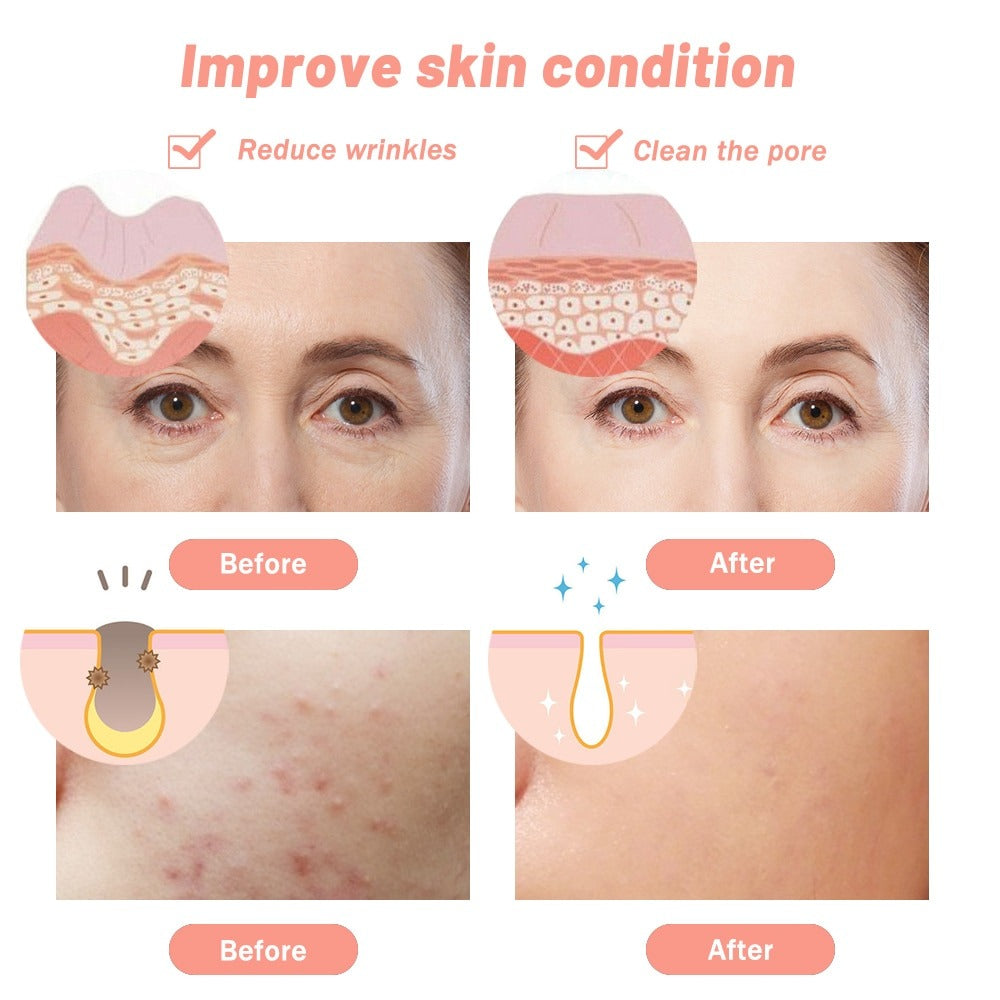 7 Color LED Face & Neck Beauty Mask
