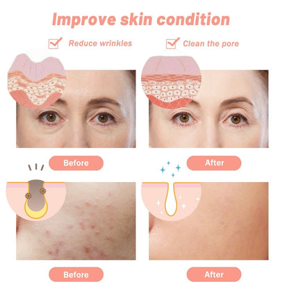 7 Color LED Face & Neck Beauty Mask