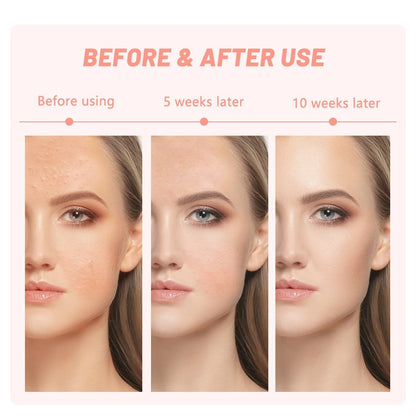 7 Color LED Face & Neck Beauty Mask
